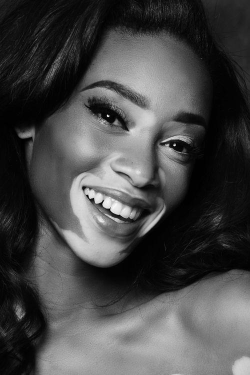 Key visual of Winnie Harlow