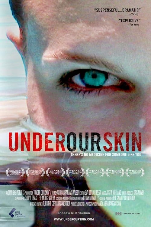 Key visual of Under Our Skin