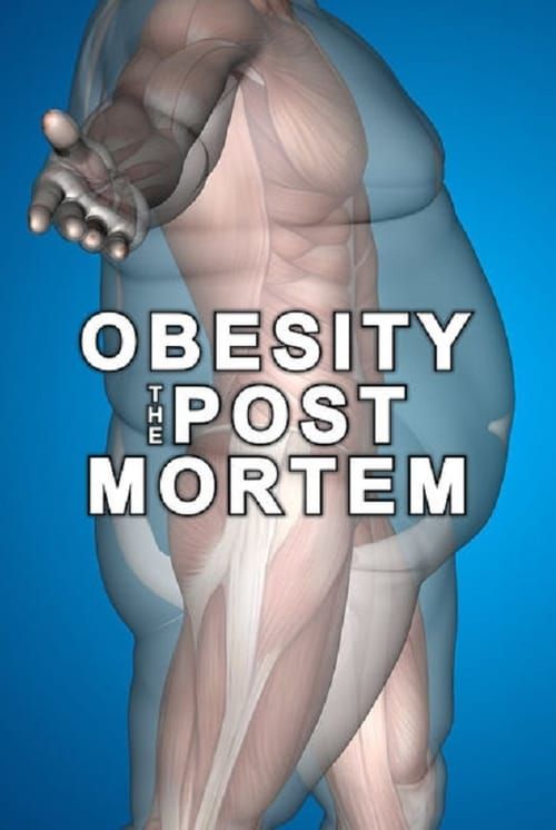 Key visual of Obesity: The Post Mortem